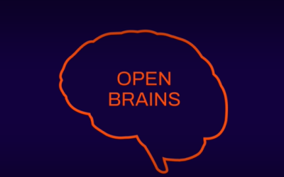 Balanced brains